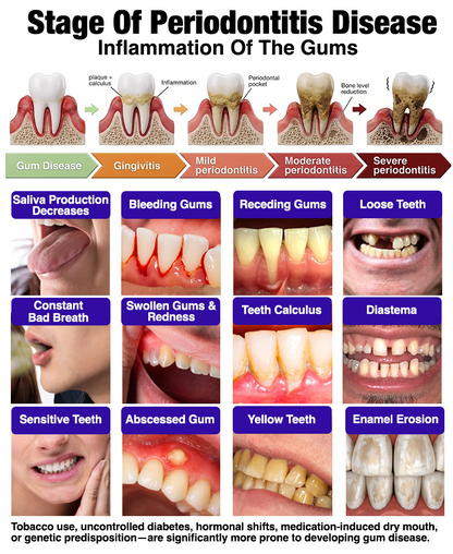 🦷🦷🦷𝐍𝐚𝐭𝐫𝐚𝐯𝐨𝐫® VioCore Bee Venom Gingivitis & Periodontitis Treatment Toothpaste