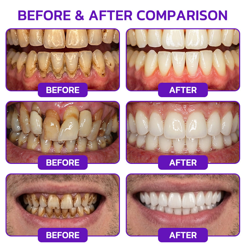🦷🦷🦷𝐍𝐚𝐭𝐫𝐚𝐯𝐨𝐫® VioCore Bee Venom Gingivitis & Periodontitis Treatment Toothpaste
