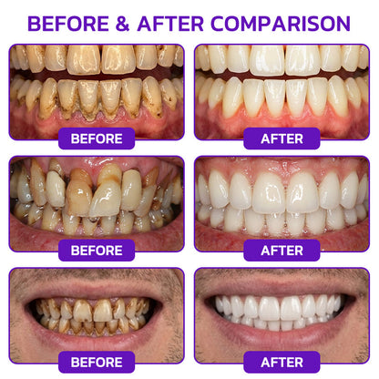 🦷🦷🦷𝐍𝐚𝐭𝐫𝐚𝐯𝐨𝐫® VioCore Bee Venom Gingivitis & Periodontitis Treatment Toothpaste