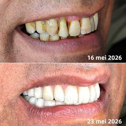 🦷🦷🦷𝐍𝐚𝐭𝐫𝐚𝐯𝐨𝐫® VioCore Bee Venom Gingivitis & Periodontitis Treatment Toothpaste