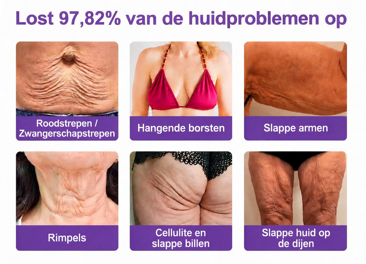 Natravor®🎗️ PDRN Multi-Peptide Massage Roller Crème – Anti-aging verzorging, hydratatie, versteviging & lifting voor een gladdere en egalere huid-b