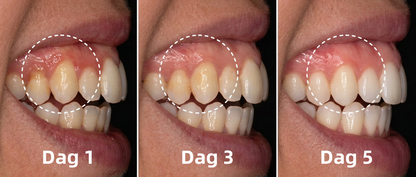 🦷🦷🦷𝐍𝐚𝐭𝐫𝐚𝐯𝐨𝐫® VioCore Bee Venom Gingivitis & Periodontitis Treatment Toothpaste