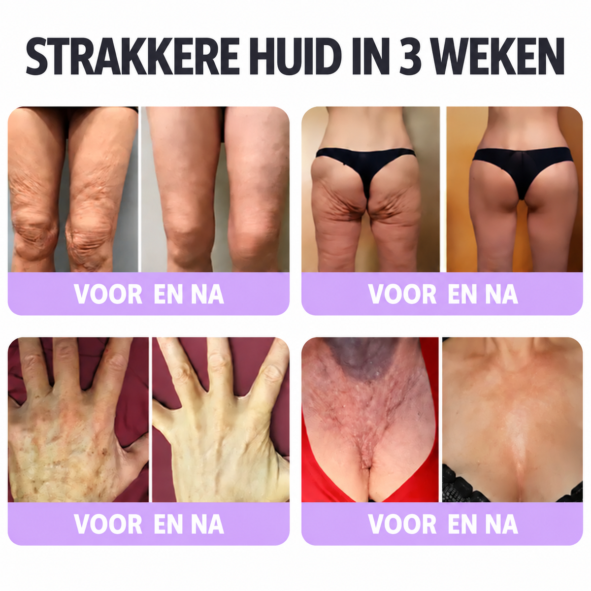 Natravor®🎗️ PDRN Multi-Peptide Massage Roller Crème – Anti-aging verzorging, hydratatie, versteviging & lifting voor een gladdere en egalere huid-b