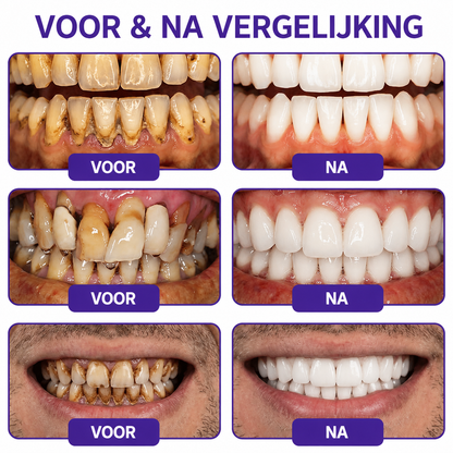 🦷🦷🦷𝐍𝐚𝐭𝐫𝐚𝐯𝐨𝐫® VioCore Bee Venom Gingivitis & Periodontitis Treatment Toothpaste