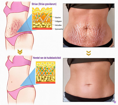Natravor®🎗️ PDRN Multi-Peptide Massage Roller Crème – Anti-aging verzorging, hydratatie, versteviging & lifting voor een gladdere en egalere huid-b