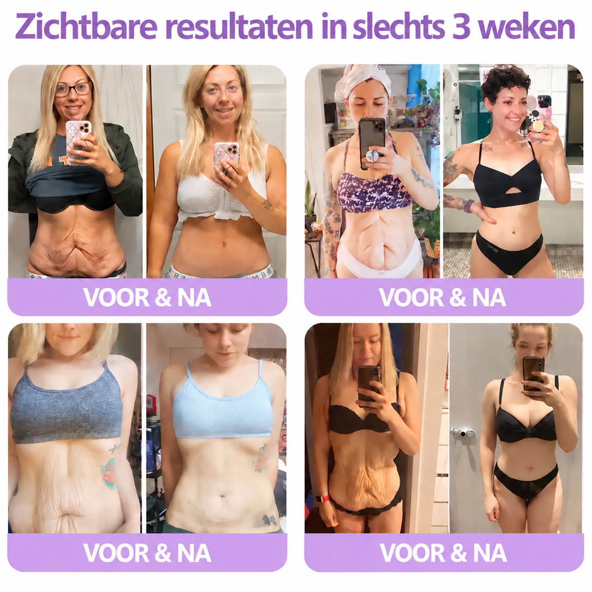 Natravor®🎗️ PDRN Multi-Peptide Massage Roller Crème – Anti-aging verzorging, hydratatie, versteviging & lifting voor een gladdere en egalere huid-b