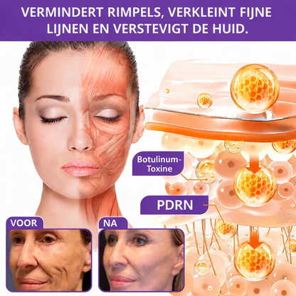Natravor®🎗️ PDRN Multi-Peptide Massage Roller Crème – Anti-aging verzorging, hydratatie, versteviging & lifting voor een gladdere en egalere huid-b