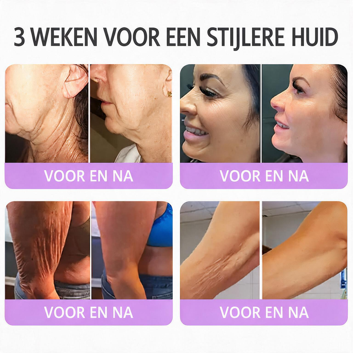 Natravor®🎗️ PDRN Multi-Peptide Massage Roller Crème – Anti-aging verzorging, hydratatie, versteviging & lifting voor een gladdere en egalere huid-b