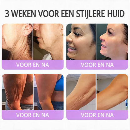 Natravor®🎗️ PDRN Multi-Peptide Massage Roller Crème – Anti-aging verzorging, hydratatie, versteviging & lifting voor een gladdere en egalere huid-b