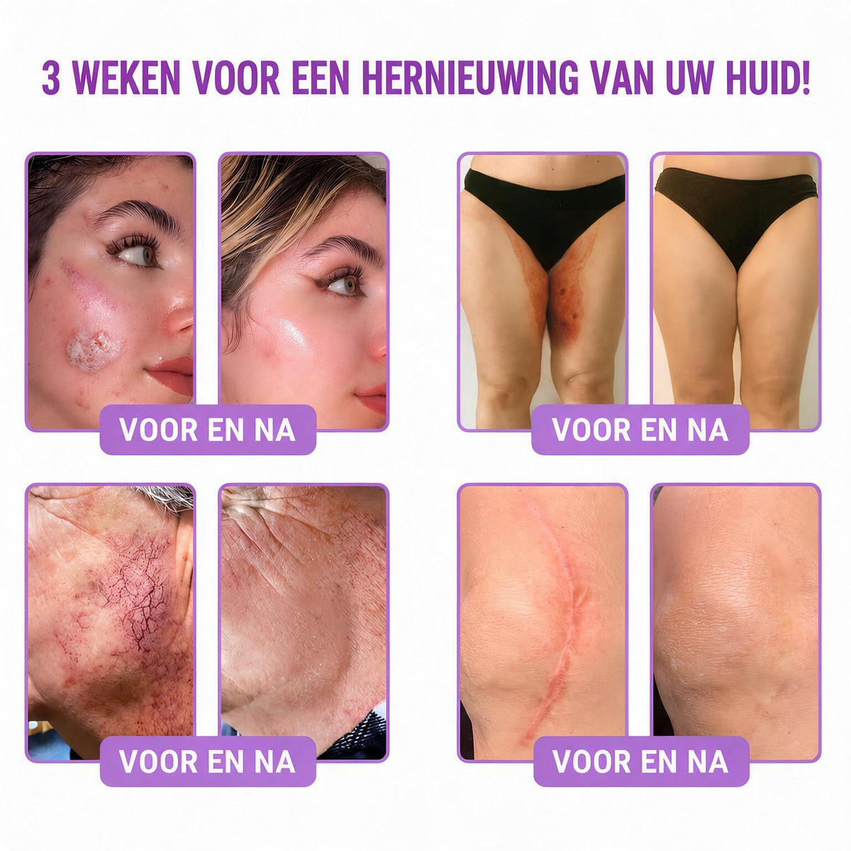 Natravor®🎗️ PDRN Multi-Peptide Massage Roller Crème – Anti-aging verzorging, hydratatie, versteviging & lifting voor een gladdere en egalere huid-b