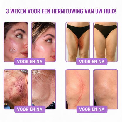 Natravor®🎗️ PDRN Multi-Peptide Massage Roller Crème – Anti-aging verzorging, hydratatie, versteviging & lifting voor een gladdere en egalere huid-b