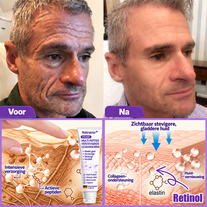 Natravor®🎗️ PDRN Multi-Peptide Massage Roller Crème – Anti-aging verzorging, hydratatie, versteviging & lifting voor een gladdere en egalere huid-b