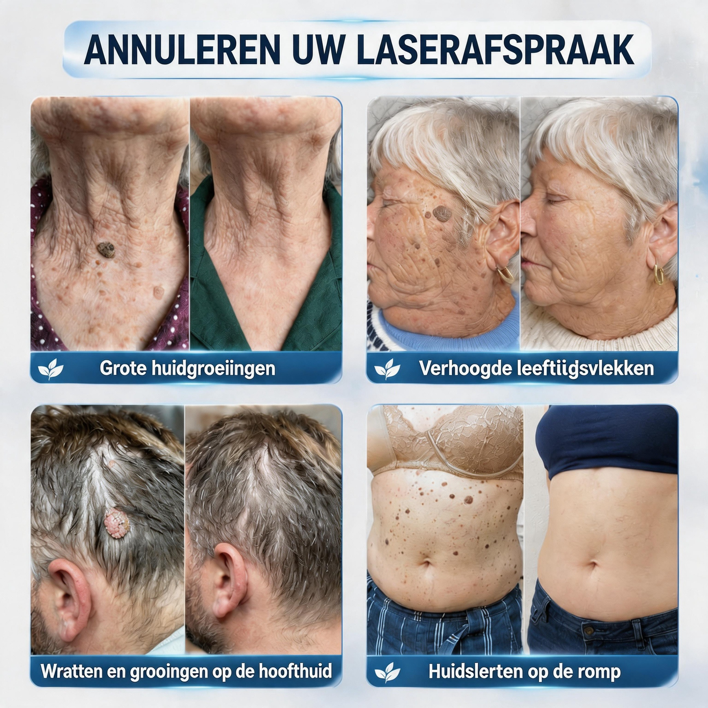 🍇Natravor® Geavanceerde Corrigerende Crème voor Huidflapjes, Moedervlekken & Vlekken – 7 Dagen Zonder Pijn & Zonder Littekens – Geavanceerde Verzorging voor Huidoneffenheden