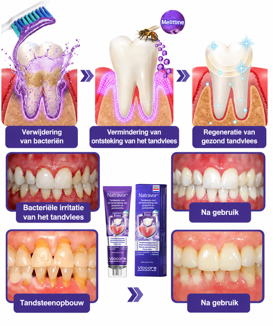 🦷🦷🦷𝐍𝐚𝐭𝐫𝐚𝐯𝐨𝐫® VioCore Bee Venom Gingivitis & Periodontitis Treatment Toothpaste