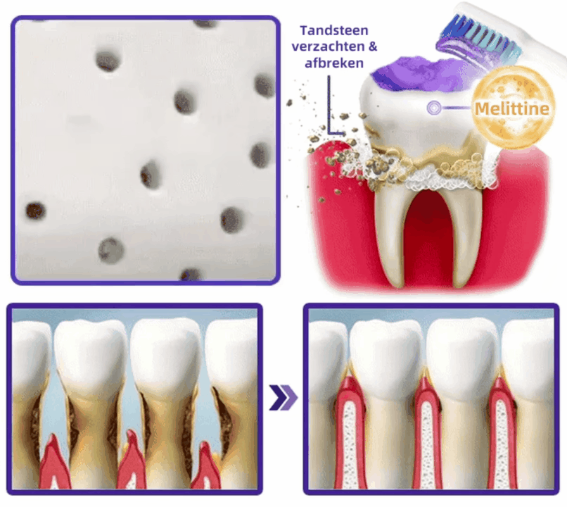 🦷🦷🦷𝐍𝐚𝐭𝐫𝐚𝐯𝐨𝐫® VioCore Bee Venom Gingivitis & Periodontitis Treatment Toothpaste