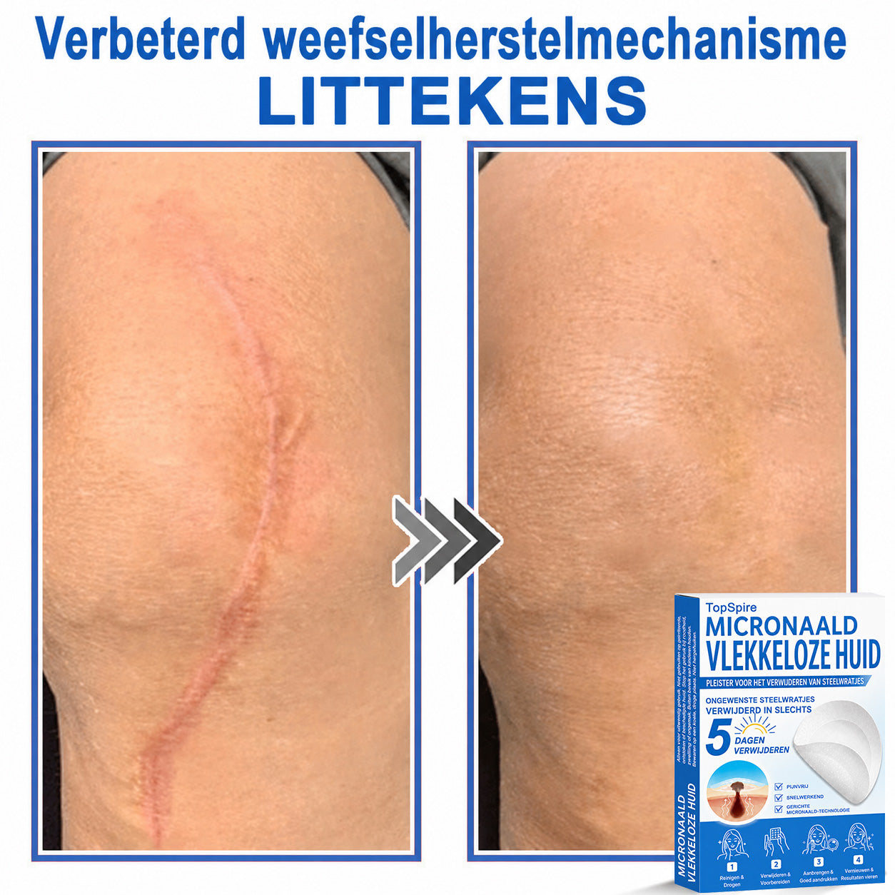 🔥 🎁 50% korting op je tweede exemplaar