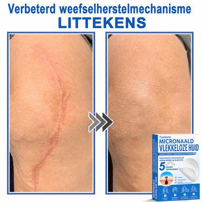 🔥 🎁 50% korting op je tweede exemplaar