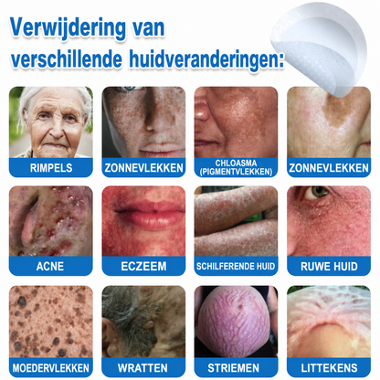 🎁 Bespaar 50% bij een tweede exemplaar