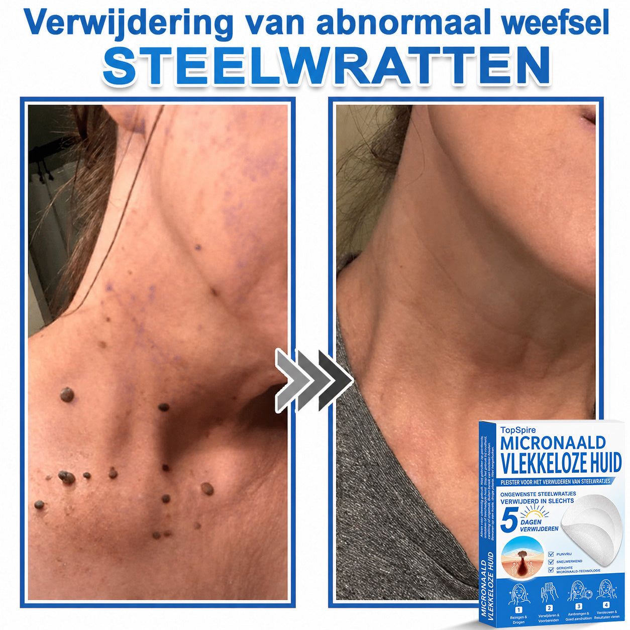 🔥 🎁 50% korting op je tweede exemplaar