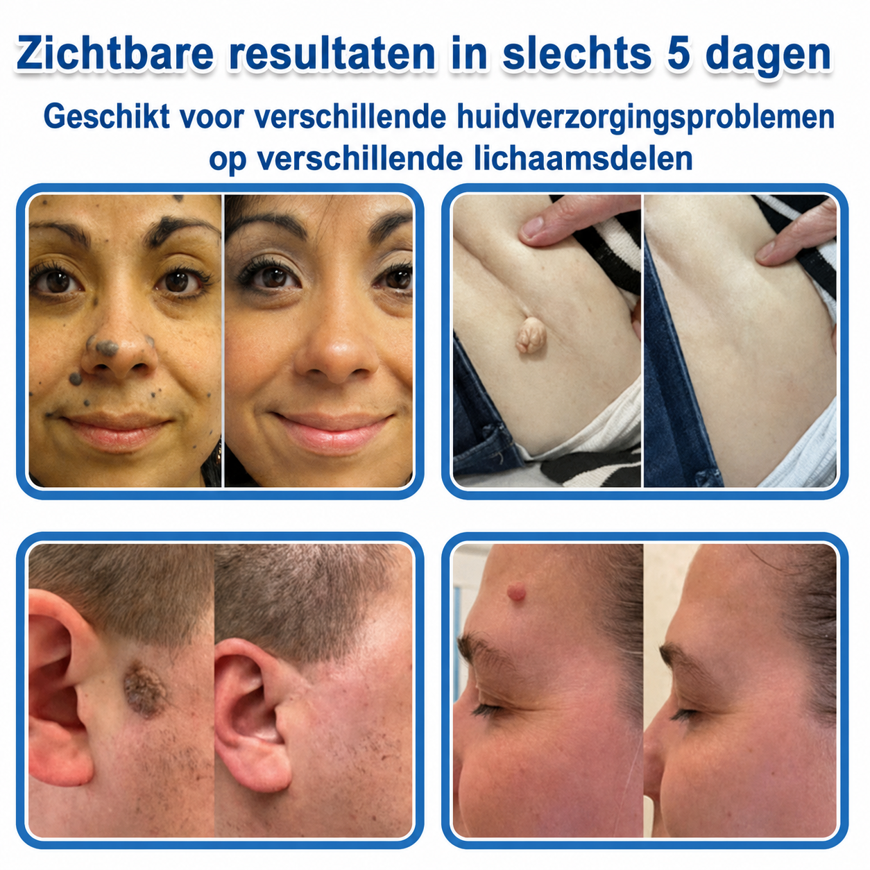 🔥 🎁 50% korting op je tweede exemplaar