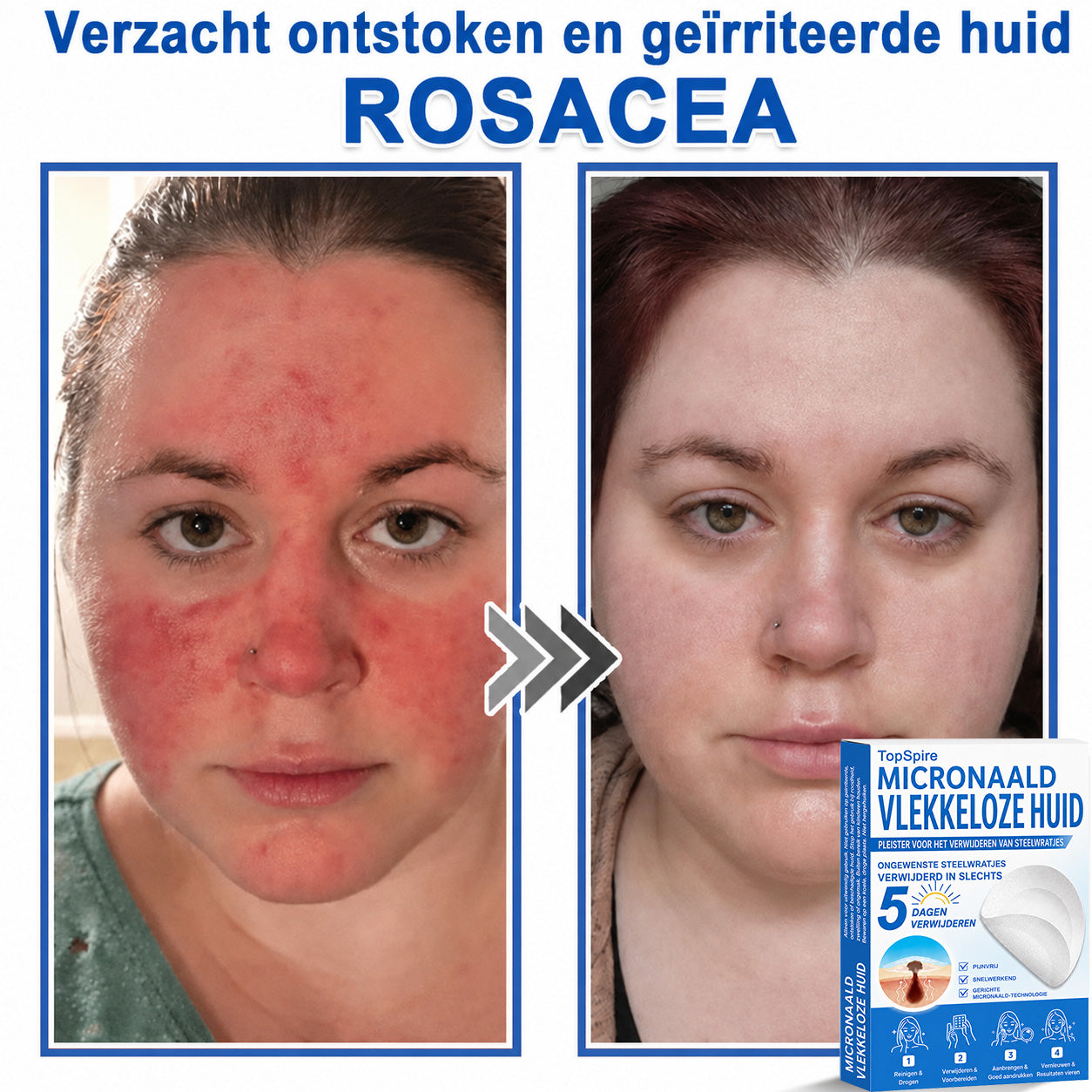 🔥 🎁 50% korting op je tweede exemplaar
