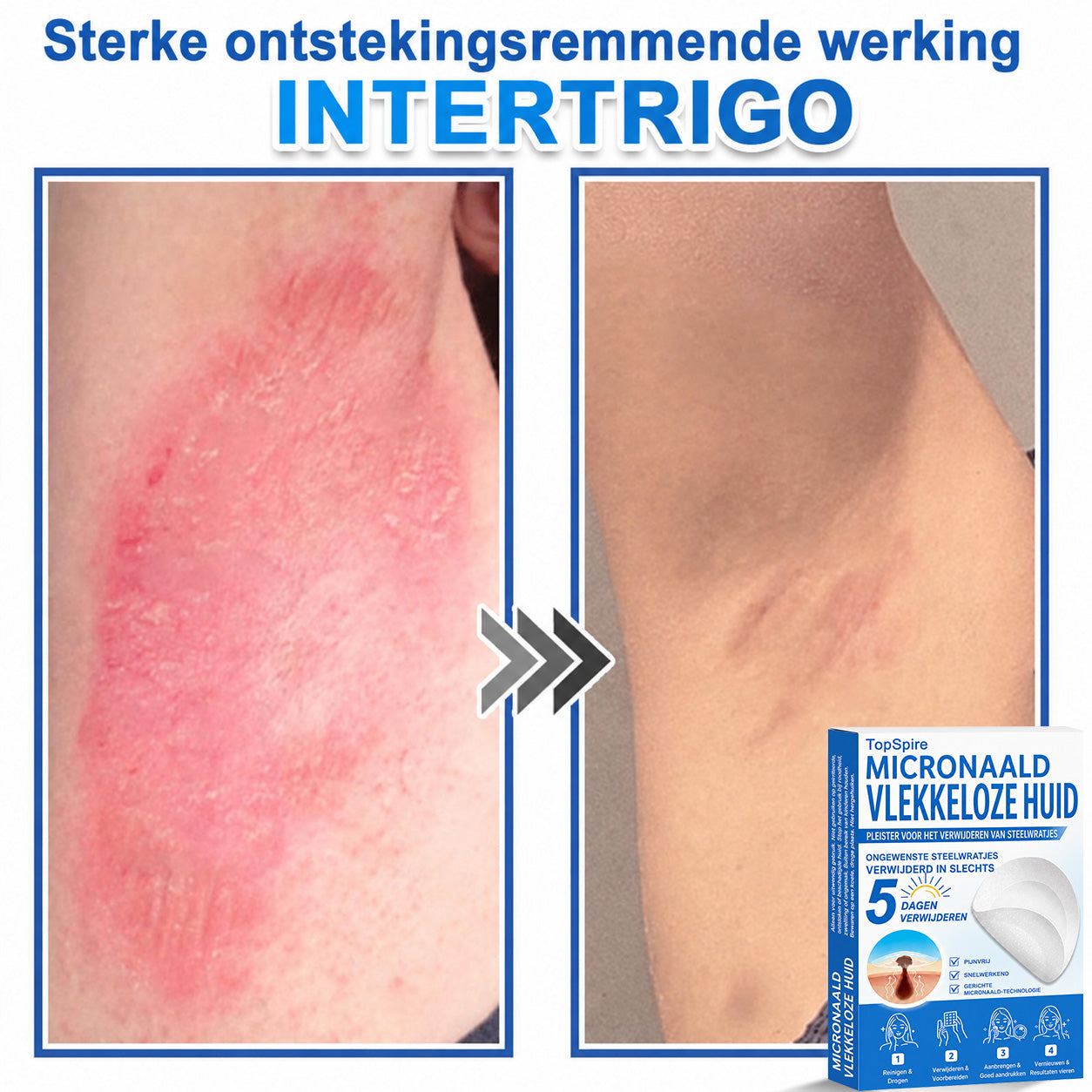 🔥 🎁 50% korting op je tweede exemplaar
