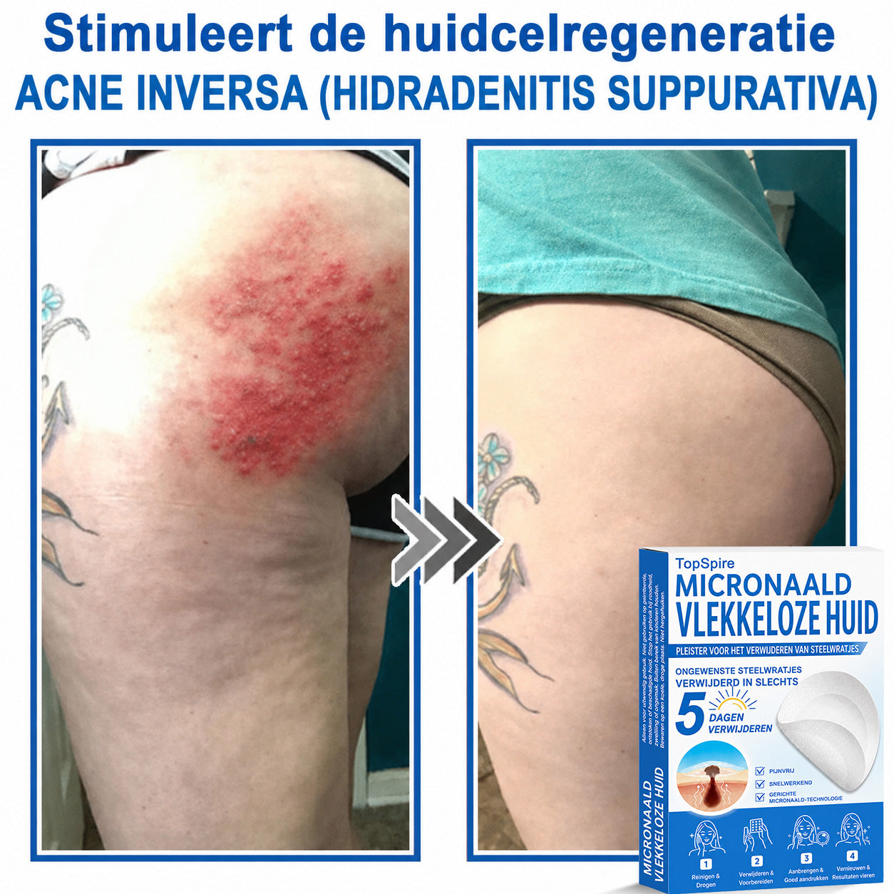 🎁 Bespaar 50% bij een tweede exemplaar