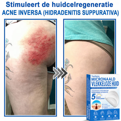 🎁 Bespaar 50% bij een tweede exemplaar