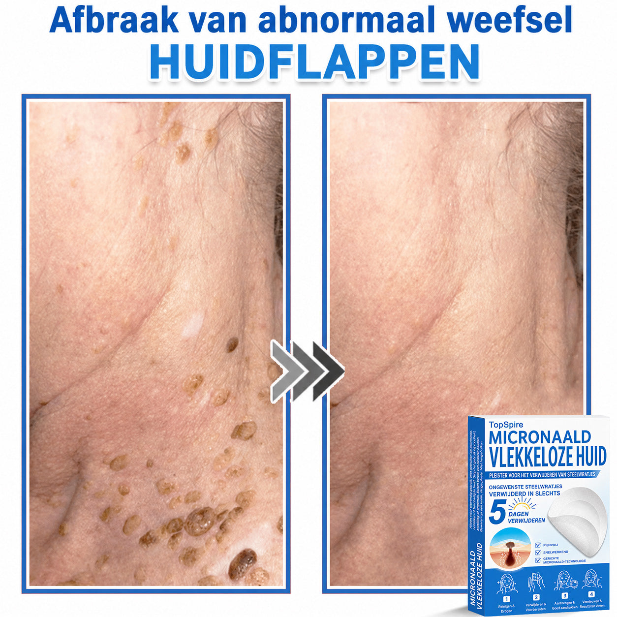 🔥 🎁 50% korting op je tweede exemplaar
