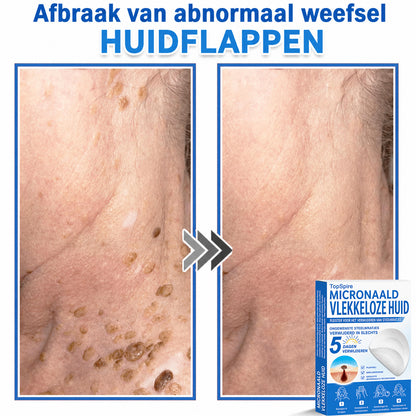 🔥 🎁 50% korting op je tweede exemplaar