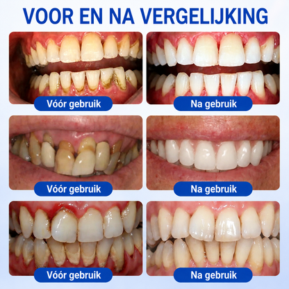 🎁 Bespaar 50% bij een tweede exemplaar