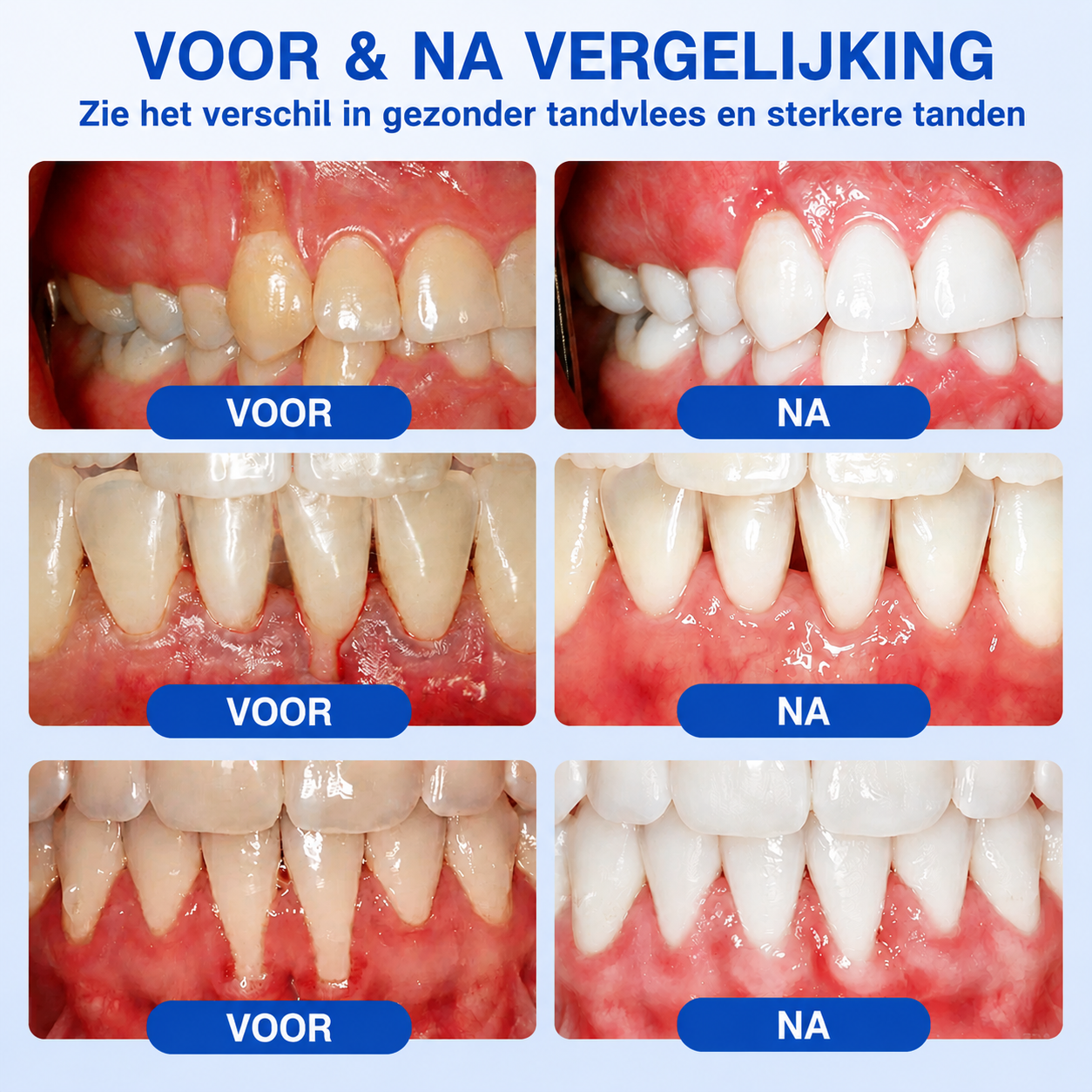 🎁 Bespaar 50% bij een tweede exemplaar