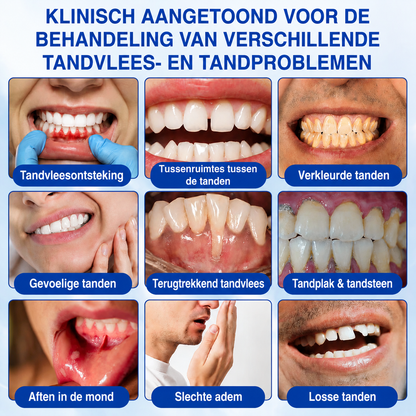 🎁 Bespaar 50% bij een tweede exemplaar