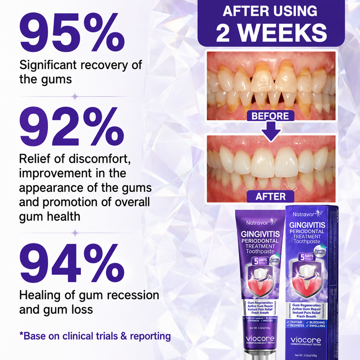 🦷🦷🦷𝐍𝐚𝐭𝐫𝐚𝐯𝐨𝐫® VioCore Bee Venom Gingivitis & Periodontitis Treatment Toothpaste