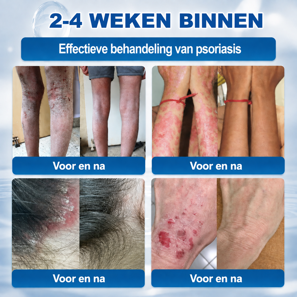 🍇Natravor® Geavanceerde Corrigerende Crème voor Huidflapjes, Moedervlekken & Vlekken – 7 Dagen Zonder Pijn & Zonder Littekens – Geavanceerde Verzorging voor Huidoneffenheden